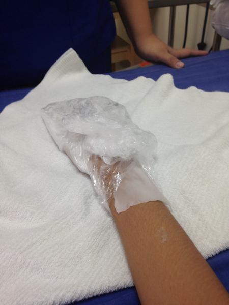 My hand dipped in paraffic wax and plastic